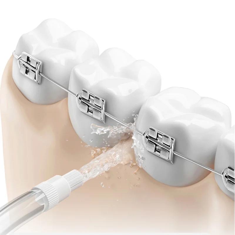 الفوهات الأصلية لجميع فوهات ال - مراجعة Oral Irrigator Flosser وسعره